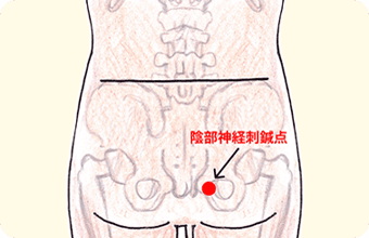 特殊鍼灸（頻尿・尿漏れ）